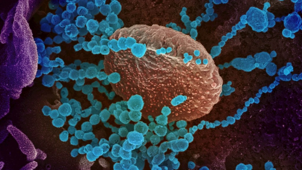 Coronavirus Covid-19 imagen células