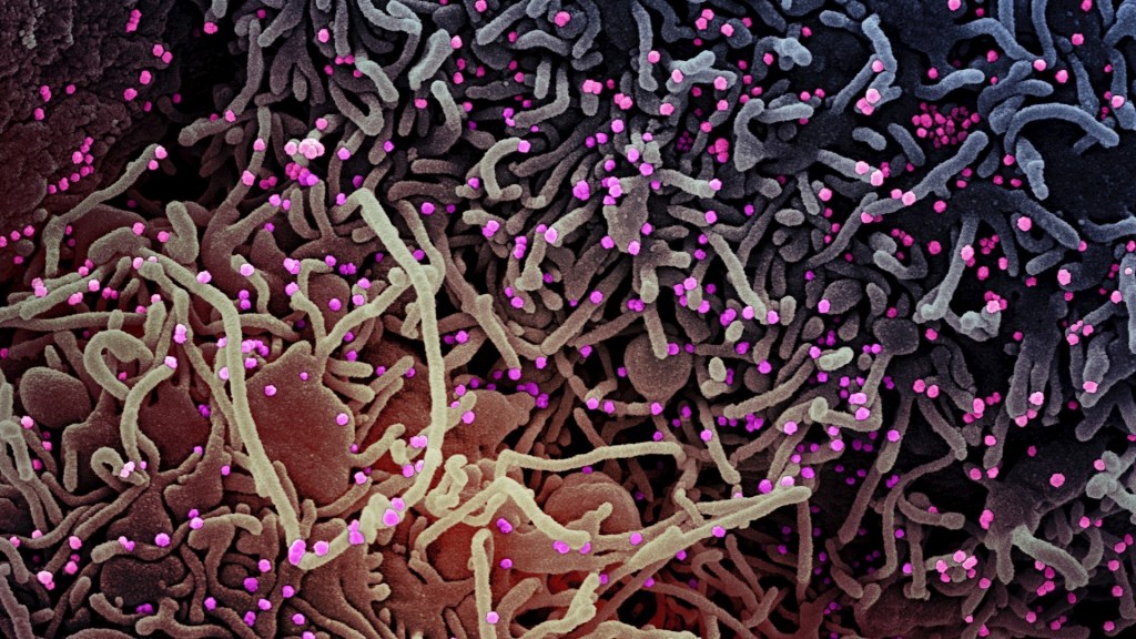 Foto muestra micrografía electrónica de barrido coloreada de una célula (púrpura) de proyecciones celulares alargadas y signos de apoptosis después de la infección del virus SARS-COV-2 (rosa), que se aislaron de una muestra de un paciente. Foto de EFE/ EPA/ NIAID/ NATIONAL INSTITUTES OF HEALTH.